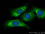 Ribosomal protein L4 Antibody in Immunocytochemistry (ICC/IF)