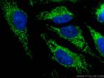 OXCT1 Antibody in Immunocytochemistry (ICC/IF)