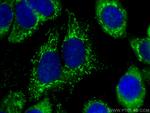 OXCT1 Antibody in Immunocytochemistry (ICC/IF)