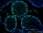 PCNA Antibody in Immunohistochemistry (Paraffin) (IHC (P))
