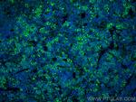 CD3 Antibody in Immunohistochemistry (Paraffin) (IHC (P))