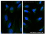 YTHDF2 Antibody in Immunocytochemistry (ICC/IF)