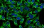 EEF1A1 Antibody in Immunocytochemistry (ICC/IF)