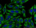 EEF1A1 Antibody in Immunocytochemistry (ICC/IF)