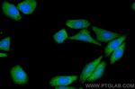 ENO1 Antibody in Immunocytochemistry (ICC/IF)