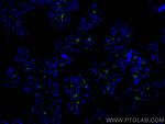 CD206 Antibody in Immunohistochemistry (PFA fixed) (IHC (PFA))