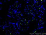 CD206 Antibody in Immunohistochemistry (PFA fixed) (IHC (PFA))