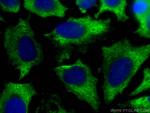DRP1 Antibody in Immunocytochemistry (ICC/IF)