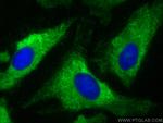 pan-RAS Antibody in Immunocytochemistry (ICC/IF)