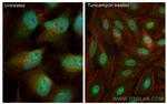 ATF4 Antibody in Immunocytochemistry (ICC/IF)