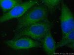 STX17 Antibody in Immunocytochemistry (ICC/IF)