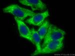 DDX3 Antibody in Immunocytochemistry (ICC/IF)