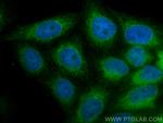 Calnexin Antibody in Immunocytochemistry (ICC/IF)