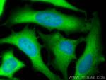 LDHB Antibody in Immunocytochemistry (ICC/IF)