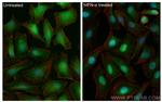STAT1 Antibody in Immunocytochemistry (ICC/IF)