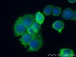 Cytokeratin 20 Antibody in Immunocytochemistry (ICC/IF)