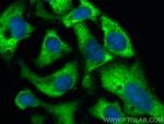 EIF3D Antibody in Immunocytochemistry (ICC/IF)