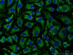 Stathmin 1 Antibody in Immunocytochemistry (ICC/IF)