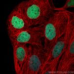 CDX2 Antibody in Immunocytochemistry (ICC/IF)