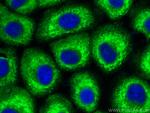 MX1 Antibody in Immunocytochemistry (ICC/IF)