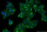 BST2 Antibody in Immunocytochemistry (ICC/IF)