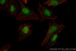 MSH3 Antibody in Immunocytochemistry (ICC/IF)