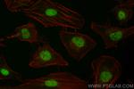TAF15 Antibody in Immunocytochemistry (ICC/IF)
