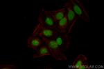 DEK Antibody in Immunocytochemistry (ICC/IF)