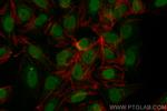 MYCL1 Antibody in Immunocytochemistry (ICC/IF)