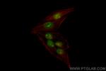 NSUN2 Antibody in Immunocytochemistry (ICC/IF)
