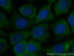 TBCD Antibody in Immunocytochemistry (ICC/IF)