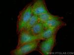 PARK7/DJ-1 Antibody in Immunocytochemistry (ICC/IF)