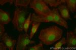 NFX1 Antibody in Immunocytochemistry (ICC/IF)