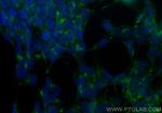 STMN2 Antibody in Immunocytochemistry (ICC/IF)