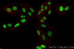 RORA Antibody in Immunocytochemistry (ICC/IF)