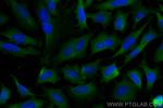 EIF2S1 Antibody in Immunocytochemistry (ICC/IF)