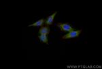 EIF2S1 Antibody in Immunocytochemistry (ICC/IF)