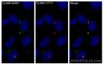 BBS4 Antibody in Immunocytochemistry (ICC/IF)