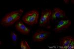 CCDC23 Antibody in Immunocytochemistry (ICC/IF)