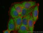 PCSK9 Antibody in Immunocytochemistry (ICC/IF)