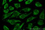 MTAP Antibody in Immunocytochemistry (ICC/IF)