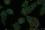 FDFT1 Antibody in Immunocytochemistry (ICC/IF)