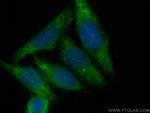 FDFT1 Antibody in Immunocytochemistry (ICC/IF)