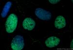 SALL4 Antibody in Immunocytochemistry (ICC/IF)