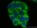 PFAS Antibody in Immunocytochemistry (ICC/IF)