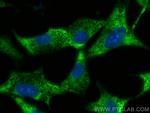 STK39 Antibody in Immunocytochemistry (ICC/IF)