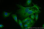 CA11 Antibody in Immunocytochemistry (ICC/IF)