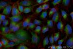 COPA Antibody in Immunocytochemistry (ICC/IF)