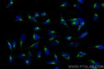 COPA Antibody in Immunocytochemistry (ICC/IF)