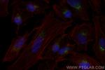 TGOLN2, TGN46 Antibody in Immunocytochemistry (ICC/IF)